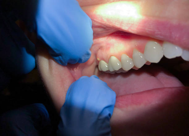 Best Emergency Treatment for Toothache in Leavenworth, WA